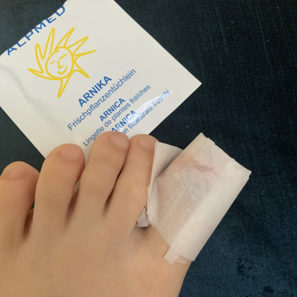 Wickel mit Arnika-Tüchlein